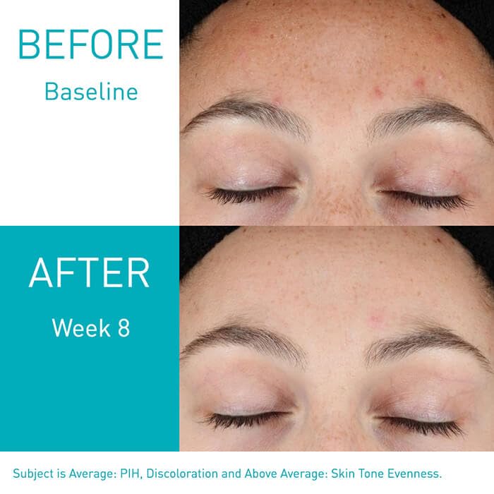 CeraVe Resurfacing Retinol Serum