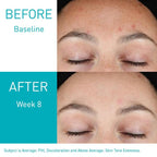 CeraVe Resurfacing Retinol Serum (1 FL OZ / 30 ml)