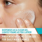 CeraVe Acne Control Cleanser (8 FL OZ / 237ml)